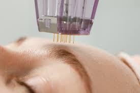 Transparente Informationen zu exosomen therapie kosten bei MorySkin